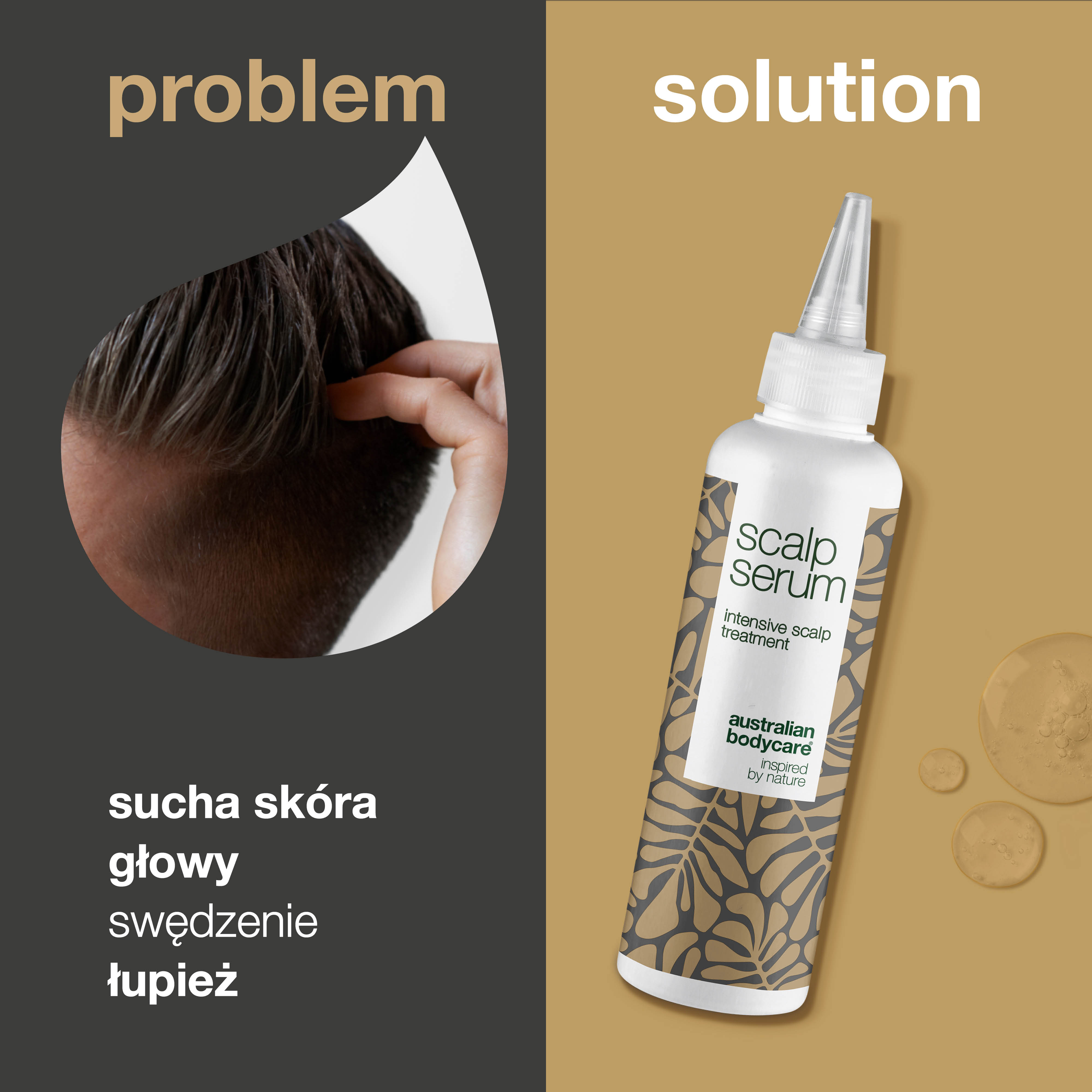 Scalp Treatment na łupież i suchą skórę głowy - Serum na swędzącą skórę głowy, włosy przetłuszczające się, suchą i podrażnioną skórę głowy