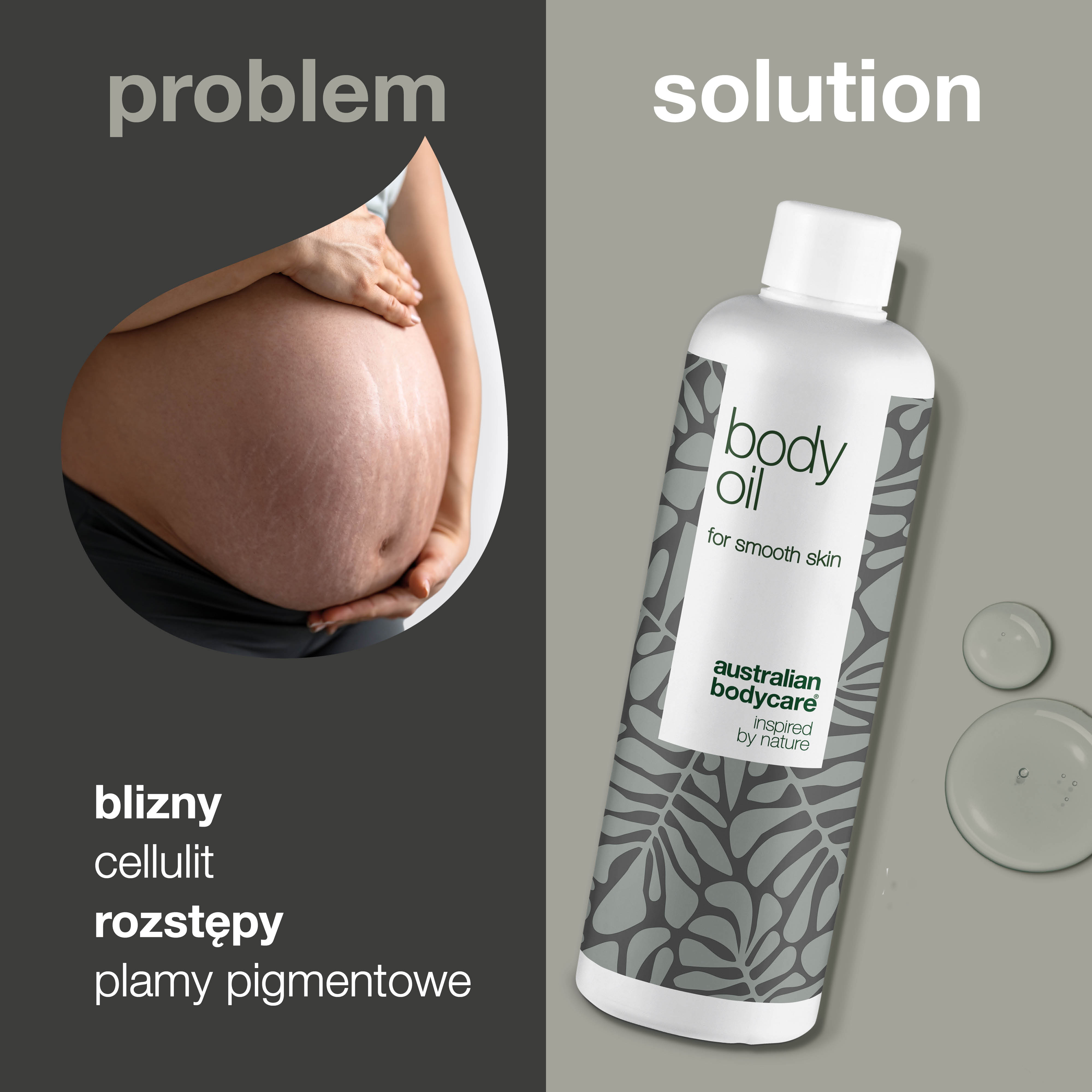Body Oil – Redukuje rozstępy, blizny i przebarwienia — Body Oil redukuje rozstępy, blizny i przebarwienia. Z olejem migdałowym, skwalanem i witaminą E intensywnie nawilża i wygładza skórę.