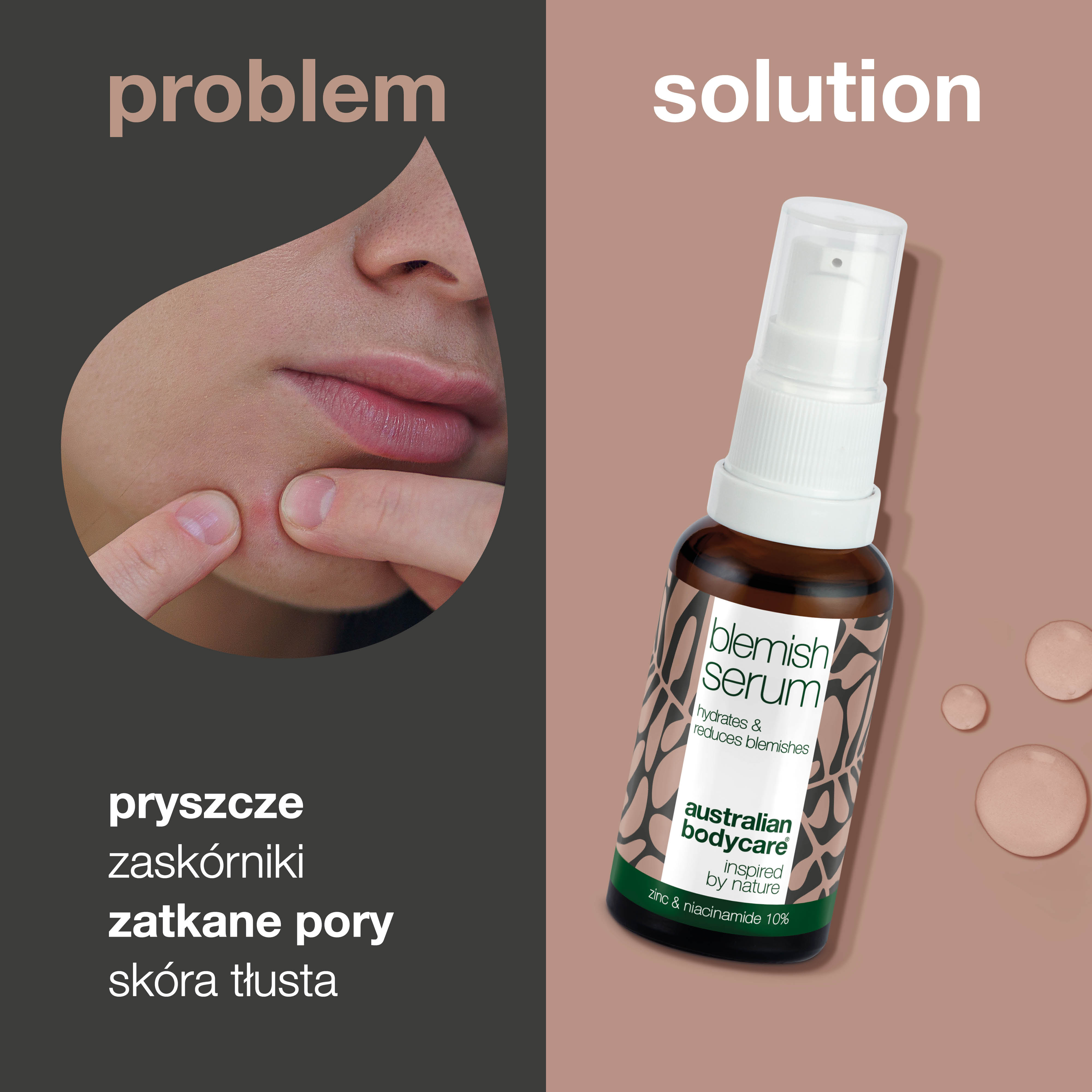 Serum z niacynamidem na pryszcze i zaskórniki - z 10% niacynamidem, 1% cynkiem i olejkiem z drzewa herbacianego na pryszcze, zaskórniki i wypryski