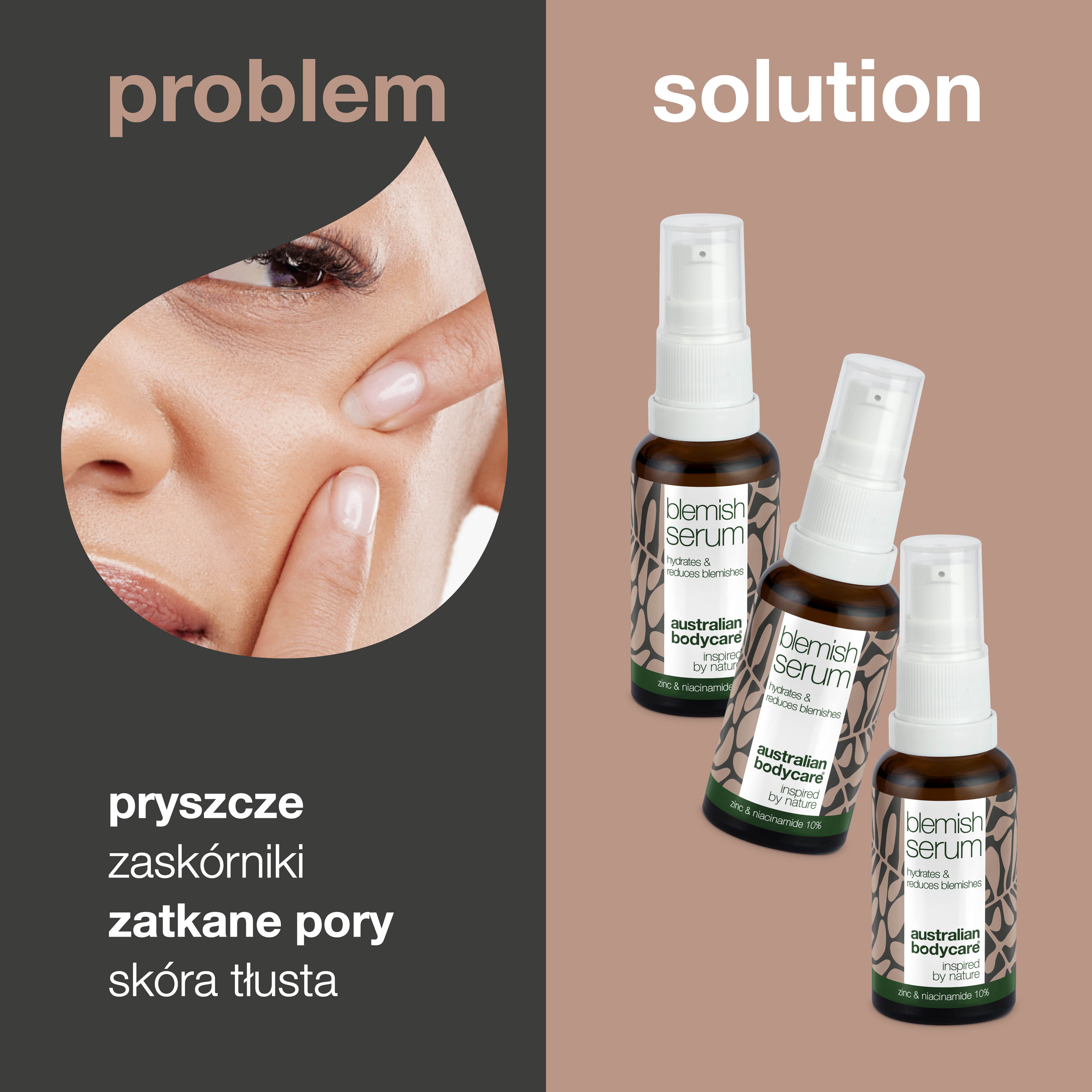 3x Serum z niacynamidem na pryszcze i zaskórniki: z 10% niacynamidem, 1% cynkiem i olejkiem z drzewa herbacianego do skóry tłustej i skłonnej do wyprysków.