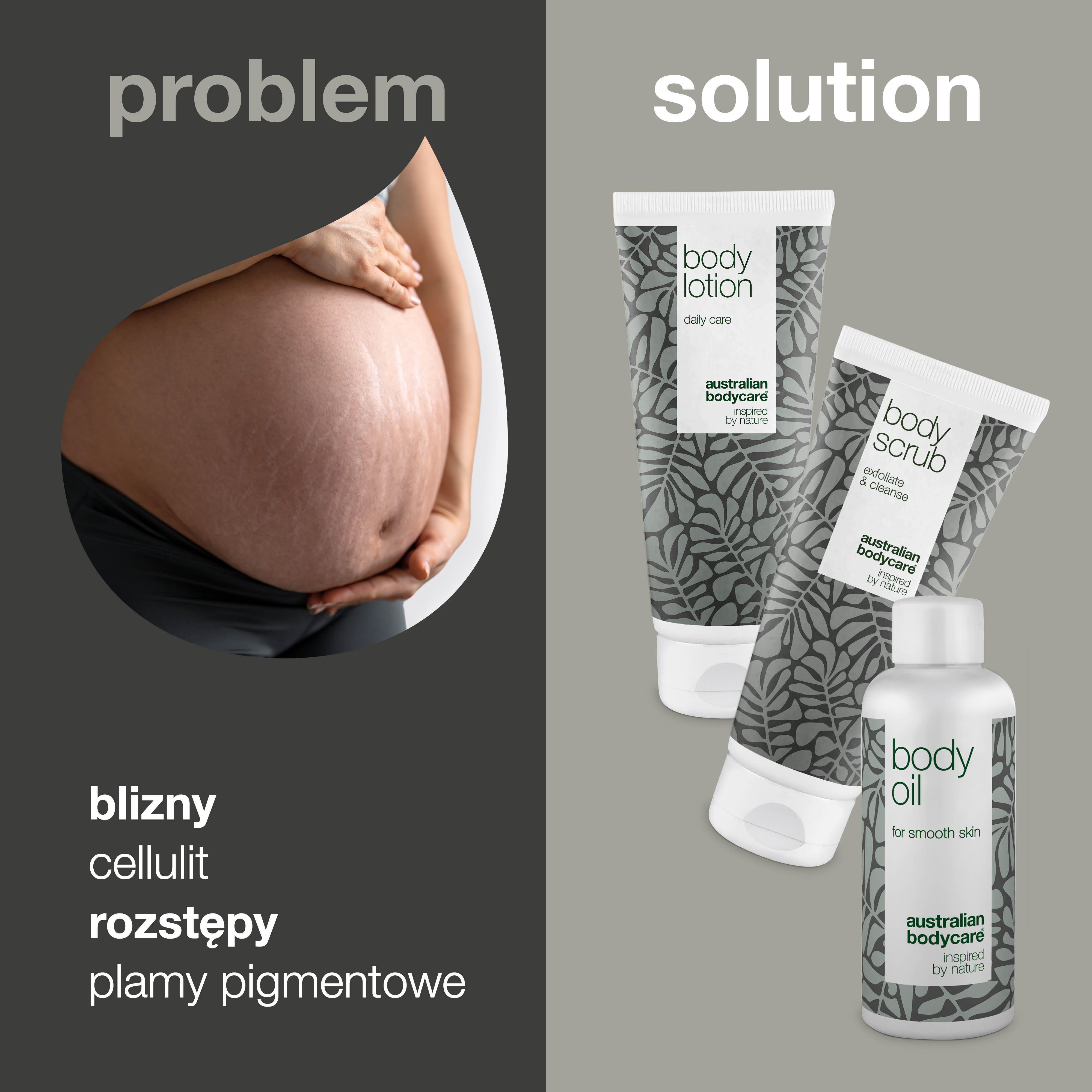 Stretch Mark Reduktor 3-pak — 3 produkty zmniejszające widoczność rozstępów i blizn