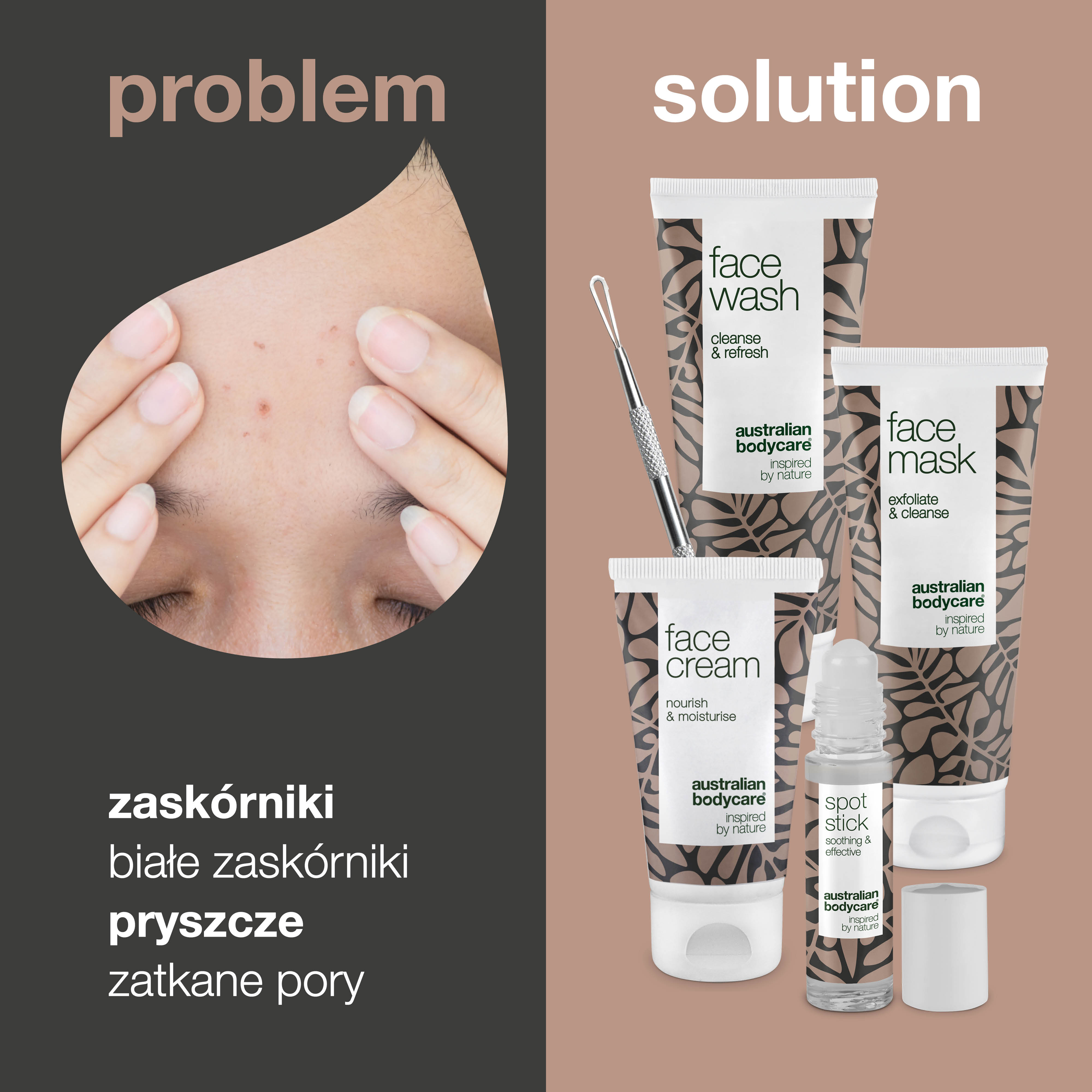 Zestaw do zaskórników: 5 produktów do usuwania zaskórników z nosa i twarzy