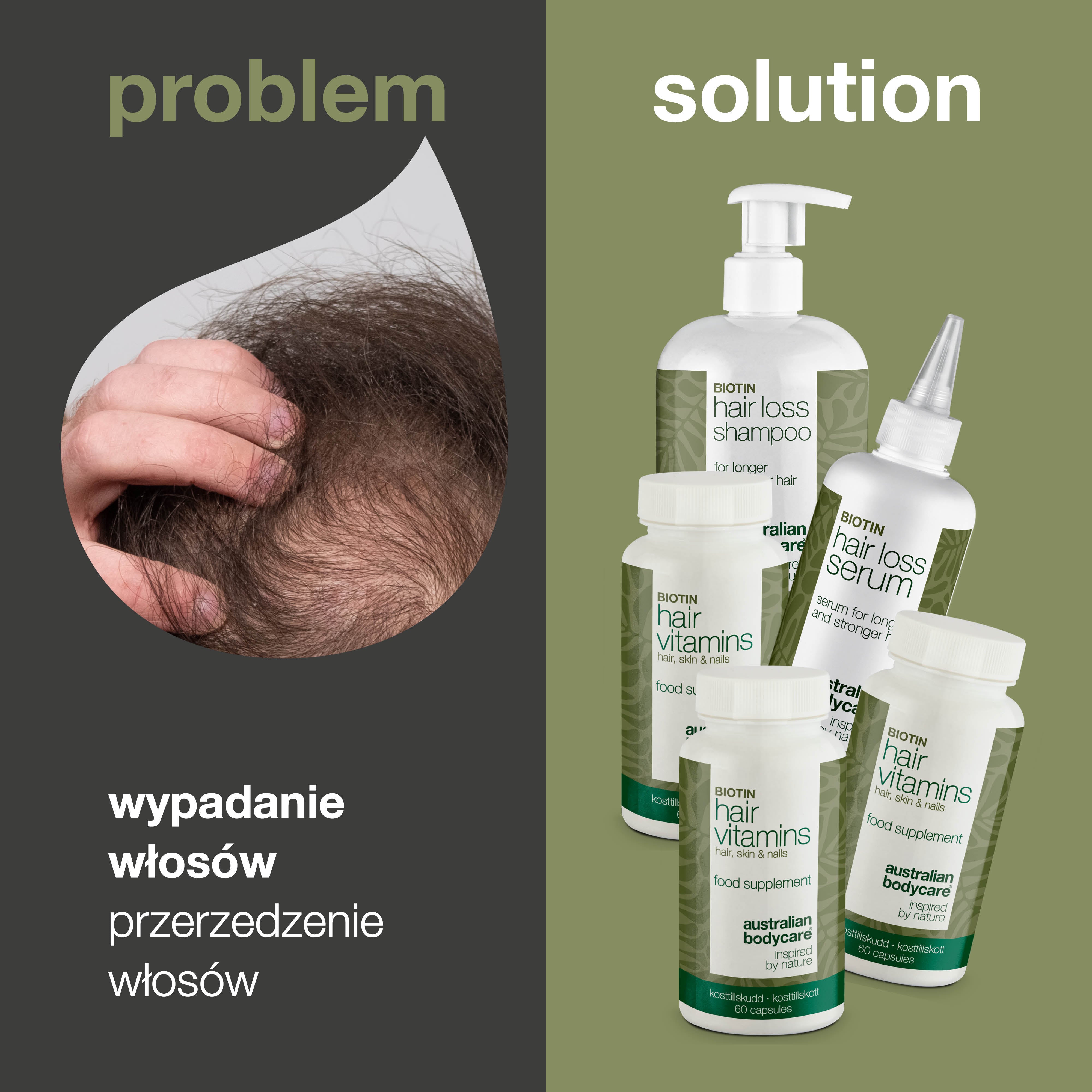 Zestaw XL przeciw wypadaniu włosów — 5 produktów przeciw wypadaniu włosów z biotyną na przerzedzające się włosy