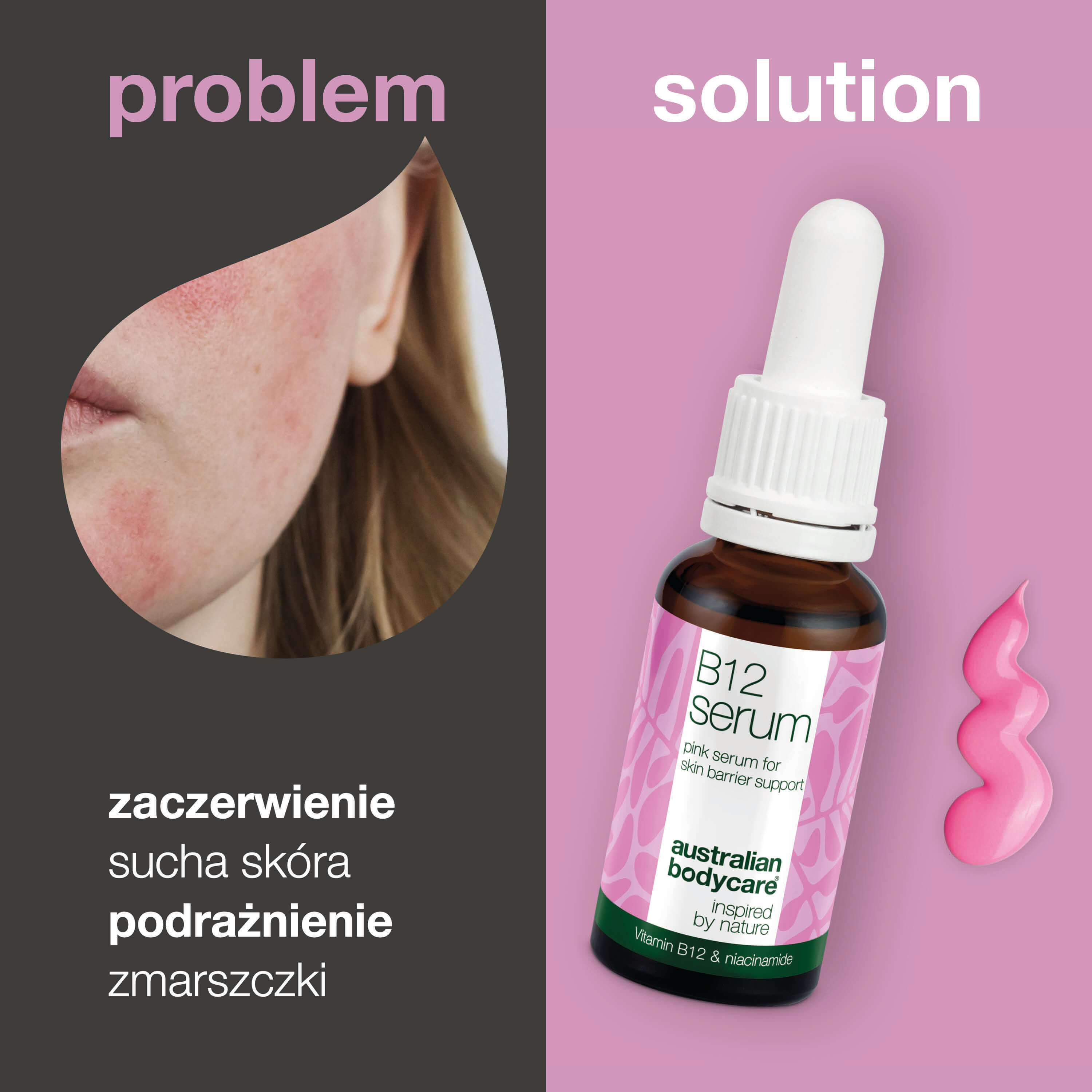 B12 Pink Serum – Zmniejsz zaczerwienienia i wzmocnij skórę — B12 Pink Serum zmniejsza zaczerwienienia i wzmacnia barierę skórną. Idealne dla suchej i wrażliwej skóry. Odkryj zdrową i promienną cerę dzięki naturalnym składnikom.