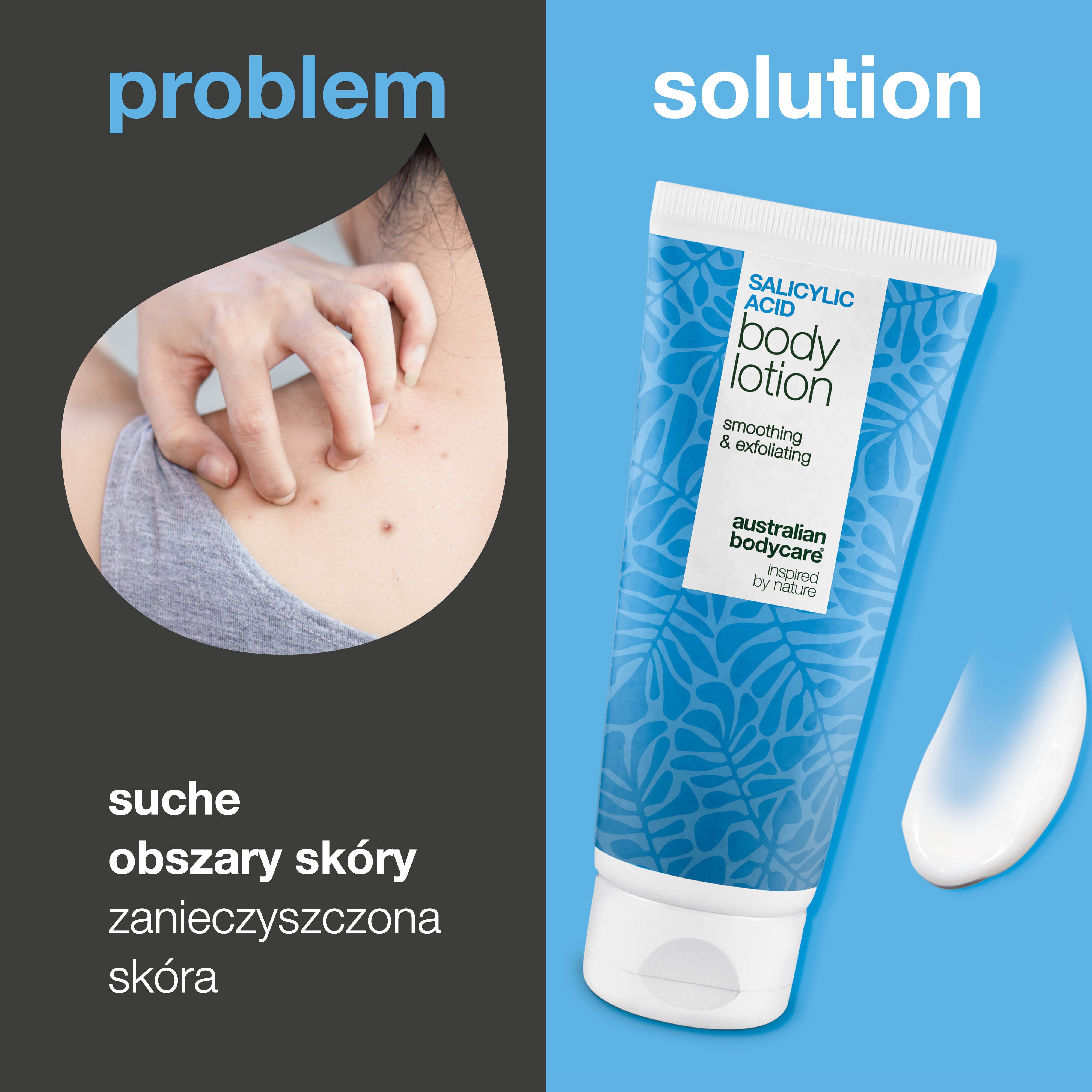 Balsam do ciała z kwasem salicylowym – skóra sucha i szorstka — Balsam z kwasem salicylowym, który złuszcza, nawilża i wygładza suchą oraz szorstką skórę. Idealny do codziennej pielęgnacji.