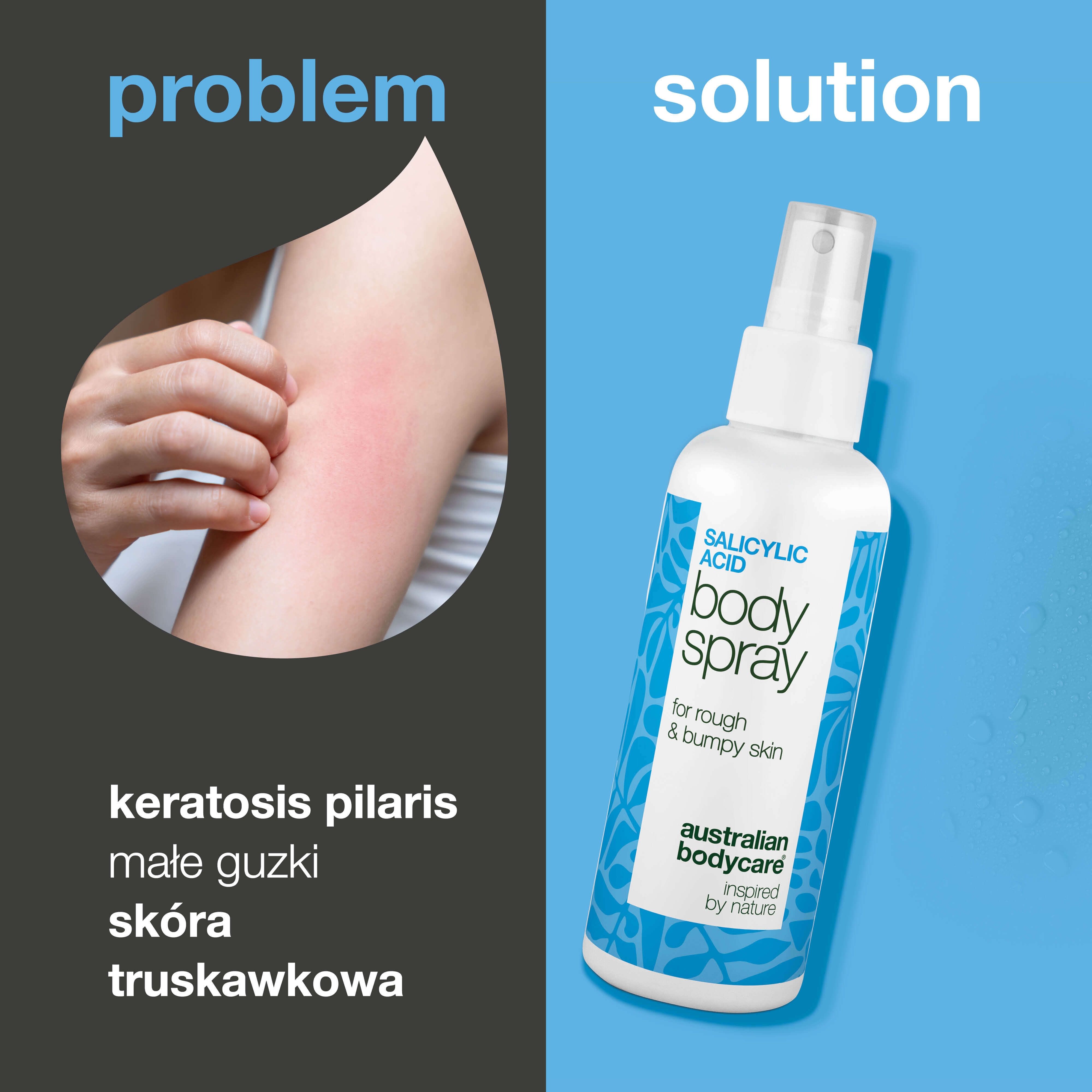 Spray na keratosis pilaris, gęsią skórkę i szorstką skórę. Zawiera kwas salicylowy, glikolowy, glicerynę i pantenol – dla gładszej, nawilżonej skóry.