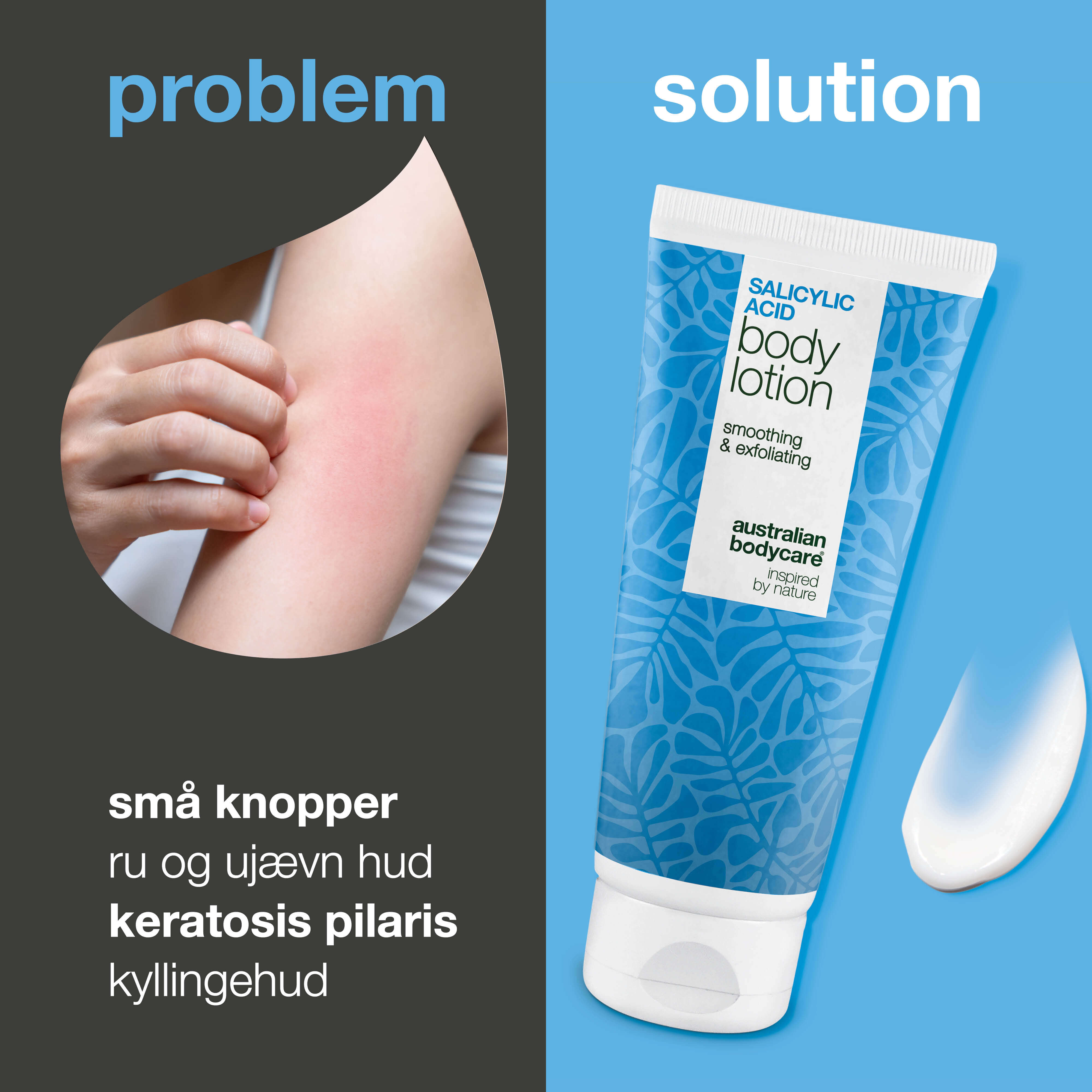 Balsam na rogowacenie okołomieszkowe wygładza szorstką skórę i redukuje krostki. Zawiera kwas salicylowy, niacynamid i cynk PCA.