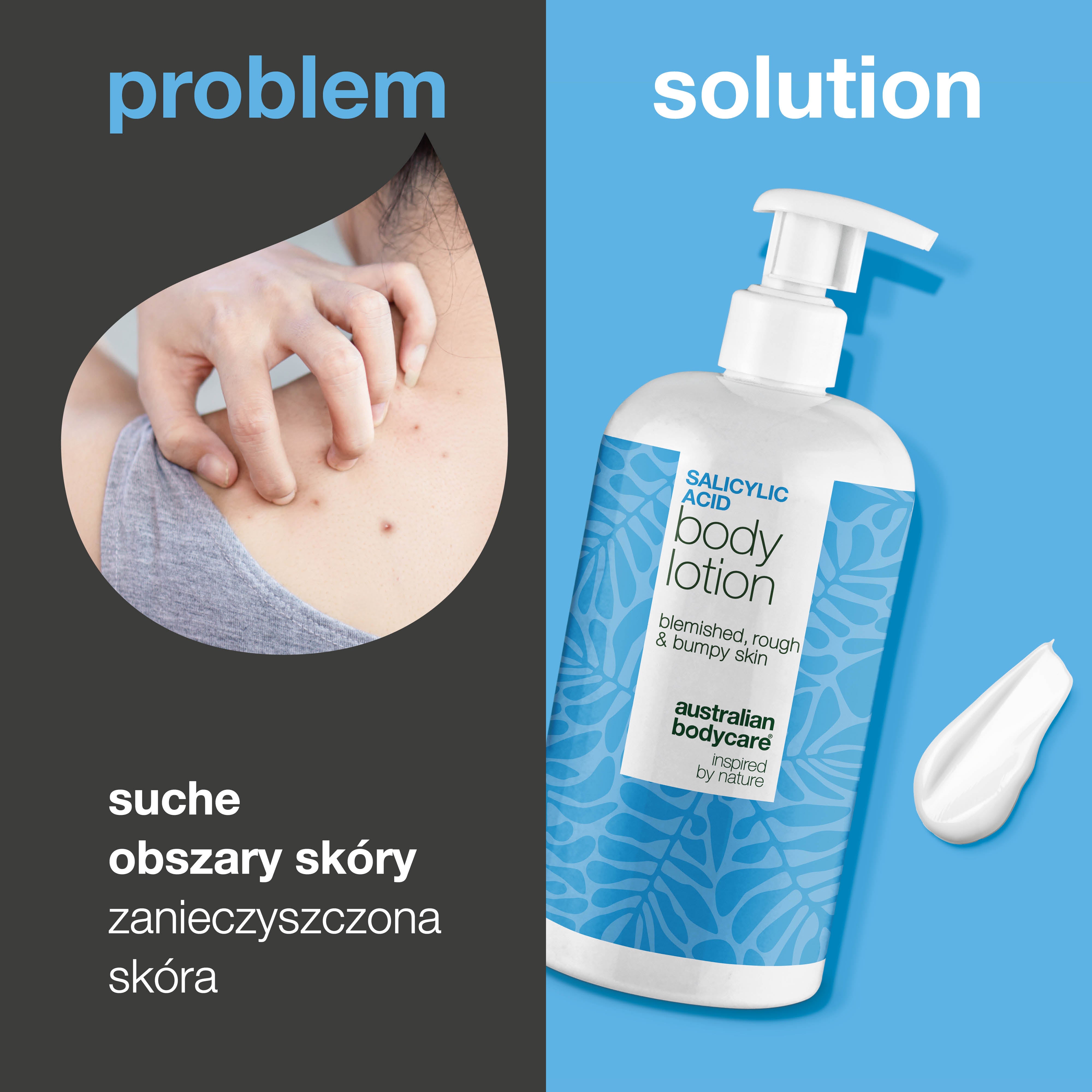 Balsam do ciała z kwasem salicylowym – skóra sucha i szorstka — Balsam z kwasem salicylowym, który złuszcza, nawilża i wygładza suchą oraz szorstką skórę. Idealny do codziennej pielęgnacji.