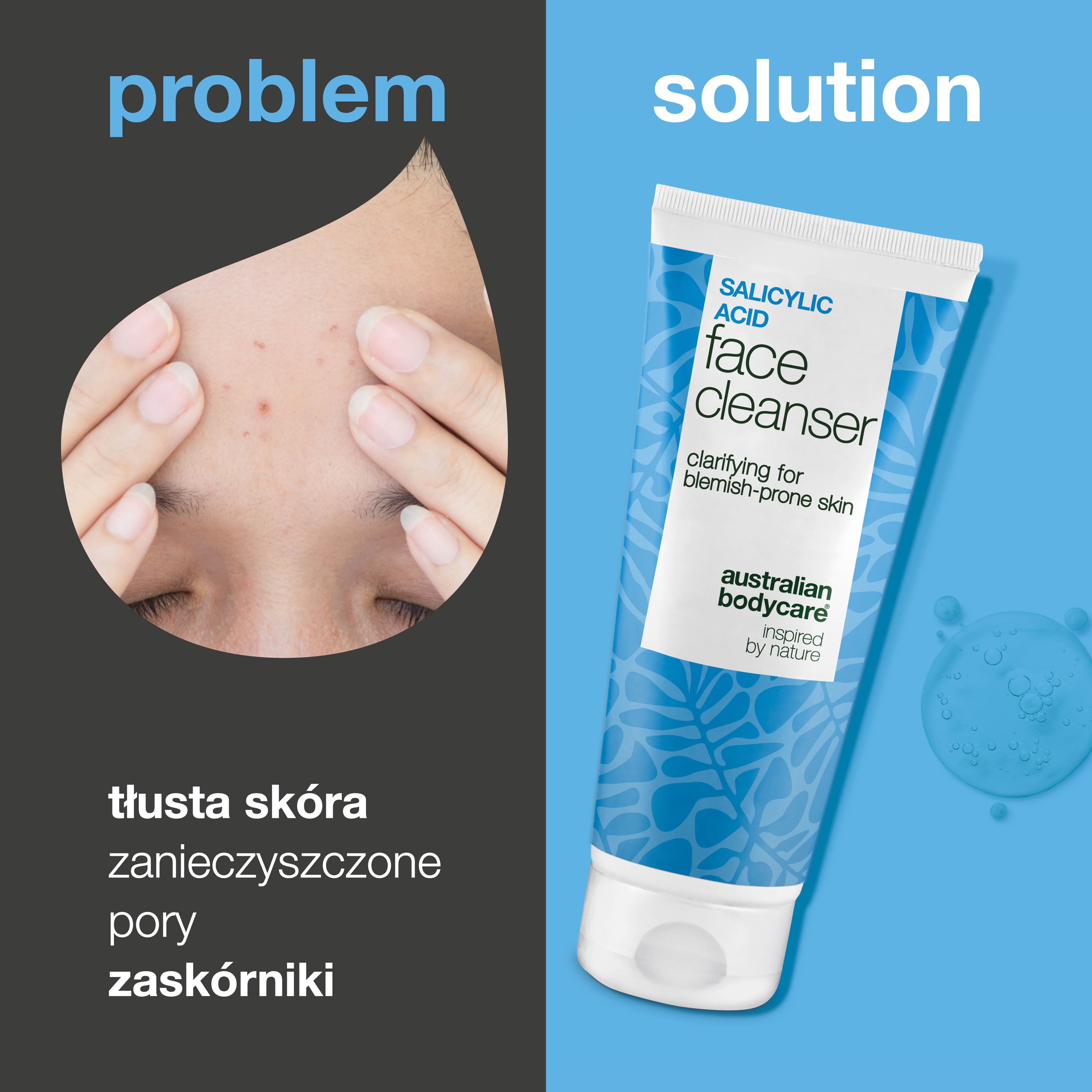 Żel z kwasem salicylowym – oczyszcza pory, usuwa trądzik i zaskórniki, redukuje przetłuszczanie skóry