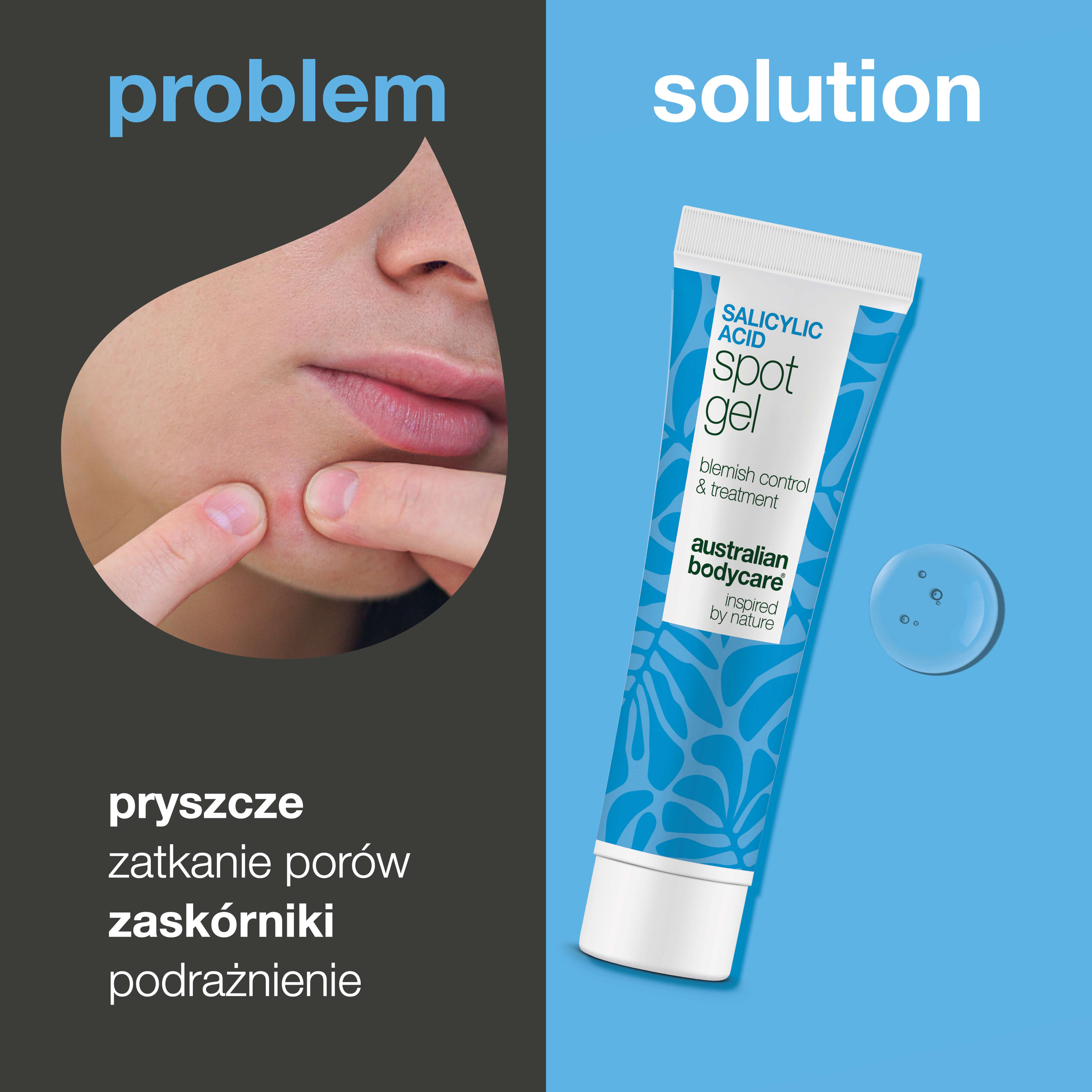 Żel Punktowy z Kwasem Salicylowym na pryszcze i zaskórniki — Żel Punktowy z Kwasem Salicylowym usuwa sebum i martwe komórki. Skuteczna pielęgnacja z kwasem salicylowym dla czystszej skóry.