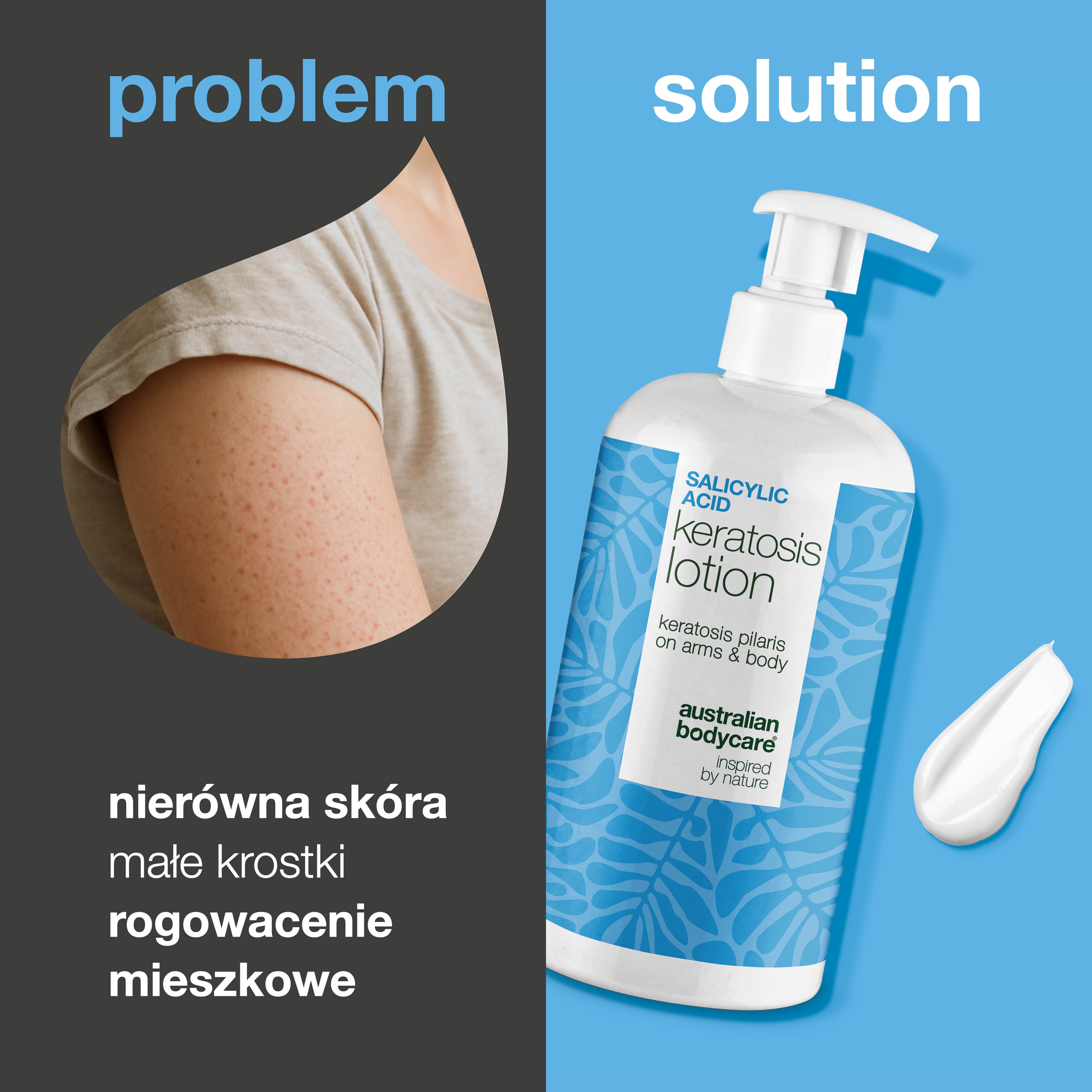 Balsam do ciała na rogowacenie okołomieszkowe i szorstką skórę — Balsam na rogowacenie mieszkowe i suchość skóry. Zawiera kwas salicylowy, niacynamid i cynk dla gładszej struktury skóry.
