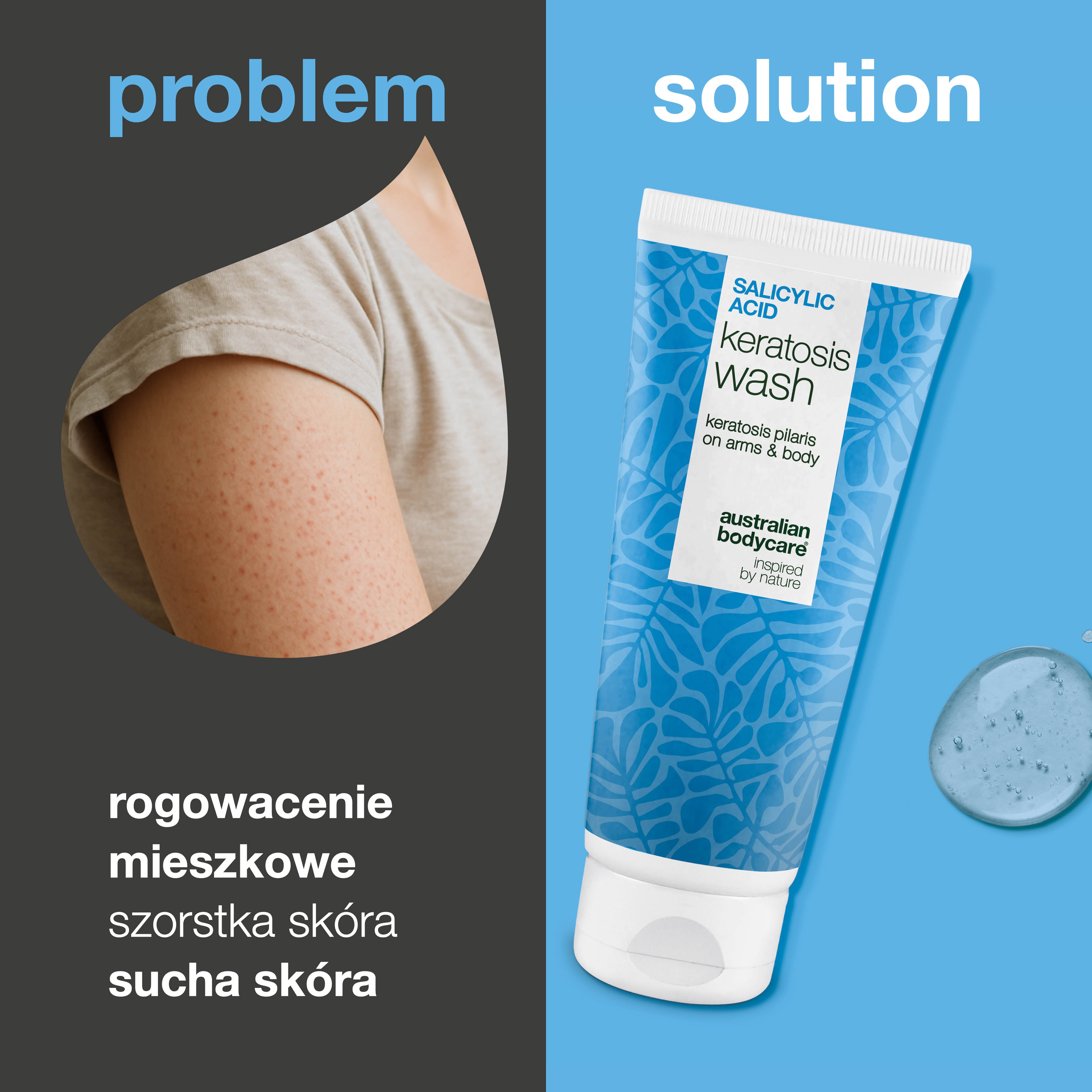 Keratosis Pilaris Body Wash na rogowacenie mieszkowe, zatkane pory i zaczerwienienia. Z kwasem salicylowym, niacynamidem, cynkiem PCA i witaminą E.