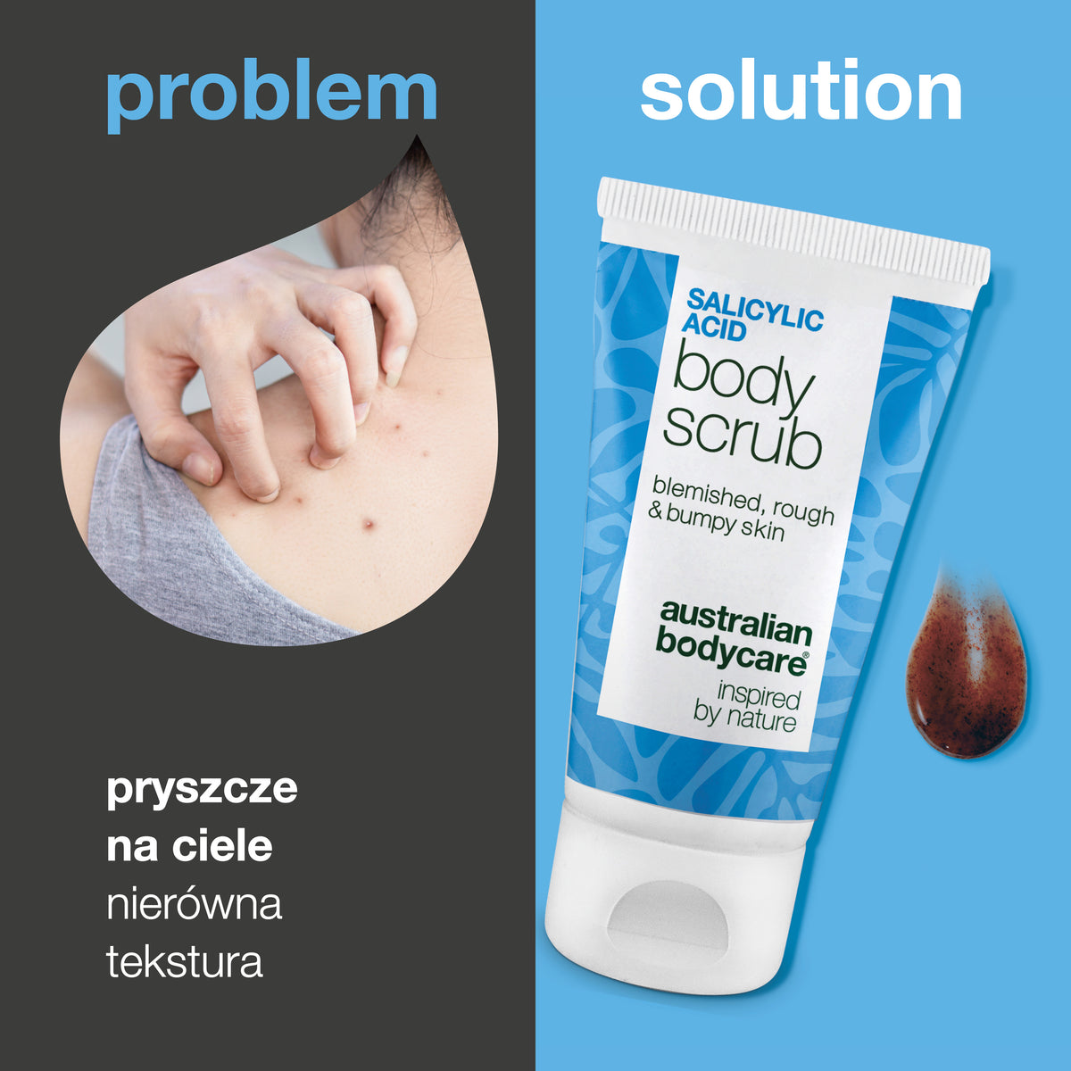 Problem i rozwiązanie: krostki na ciele, zatkane pory i nierówna skóra. Po lewej zbliżenie ramienia z krostkami, po prawej Salicylic Acid Body Scrub od Australian Bodycare