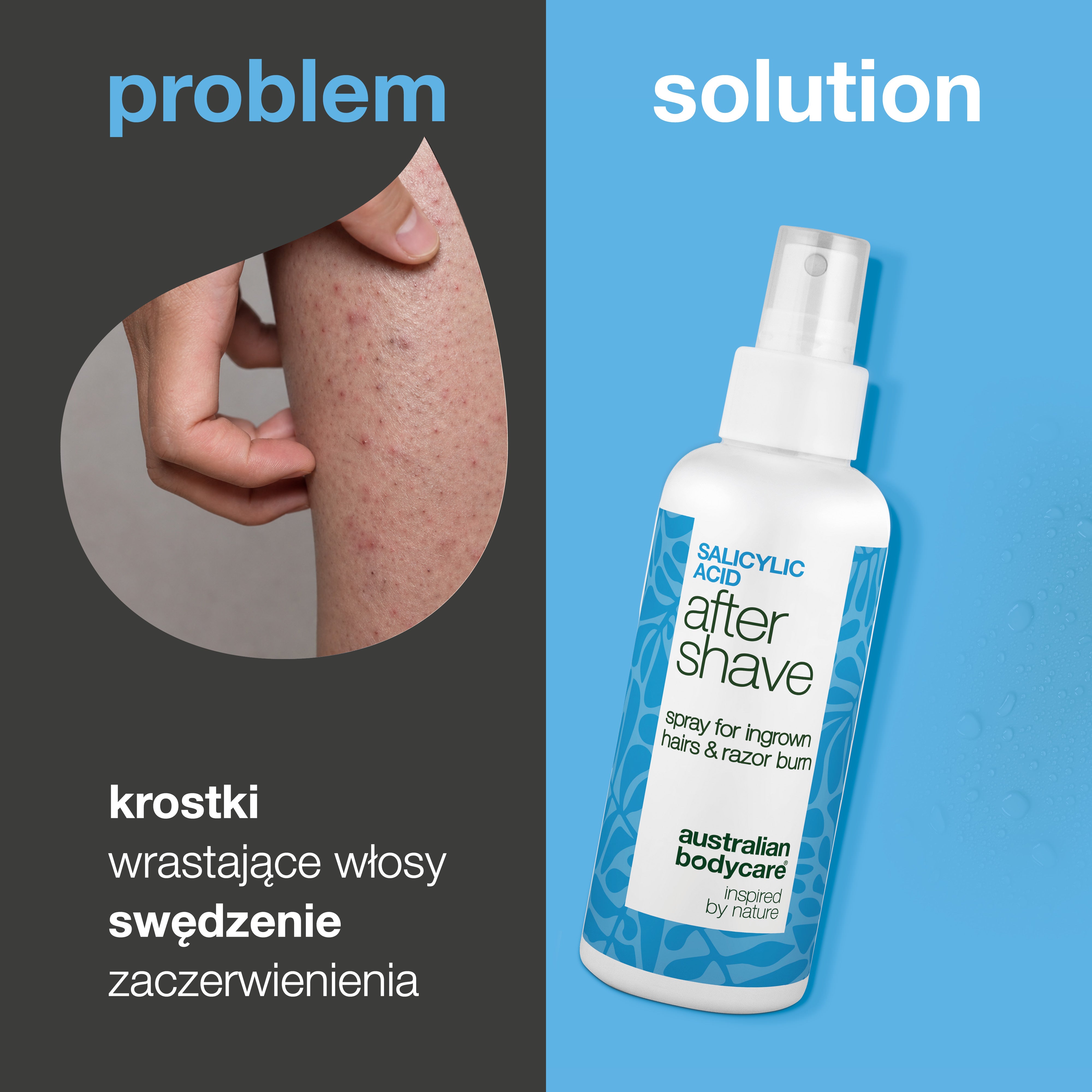 Spray po goleniu z kwasem salicylowym na krostki — Spray po goleniu na krostki i wrastające włoski. Kwas salicylowy i aloes koją swędzenie, zapewniając gładką skórę. Sprawdź teraz!