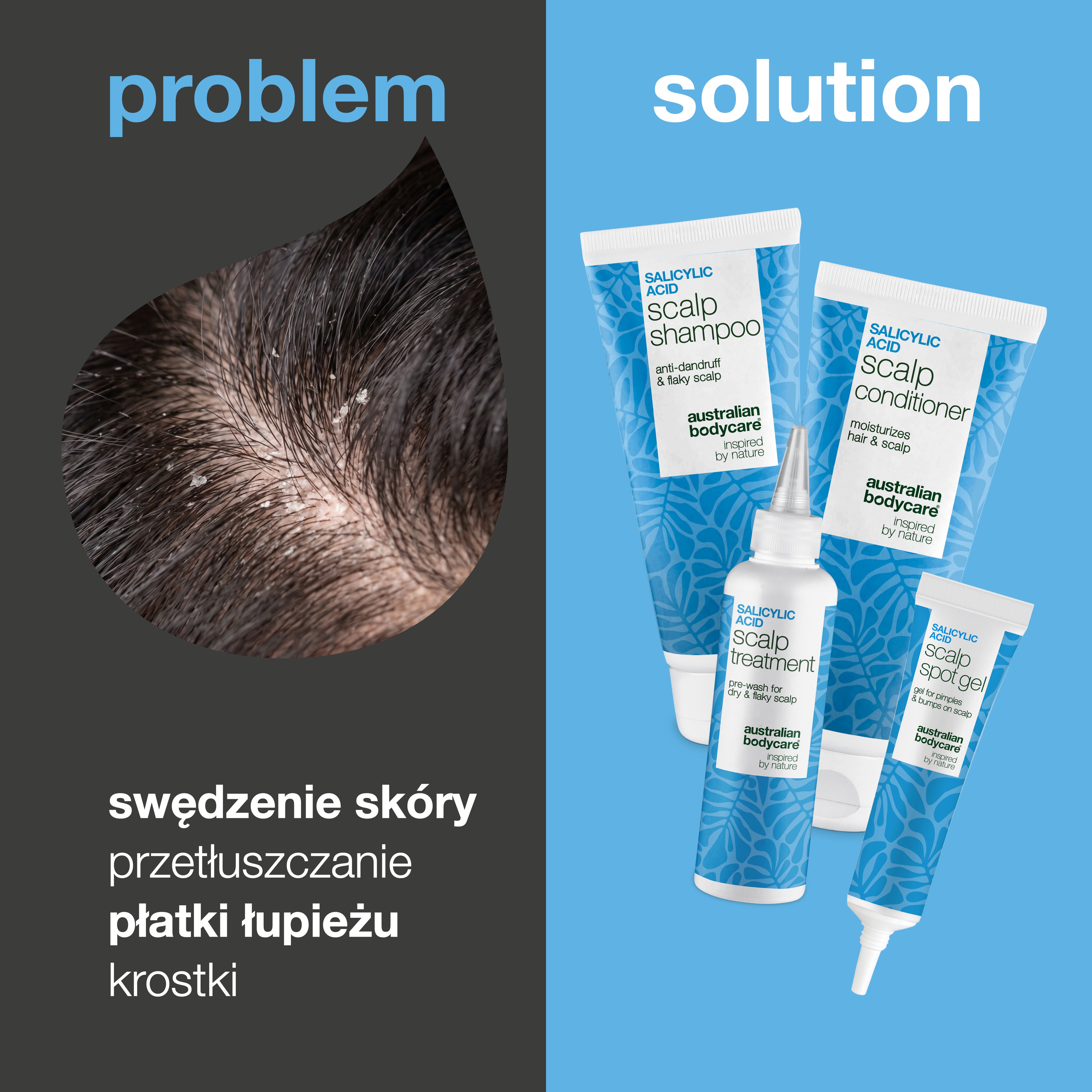 Problem i rozwiązanie: zbliżenie łupieżu na skórze głowy obok czterech produktów na świąd, łupież i krosty