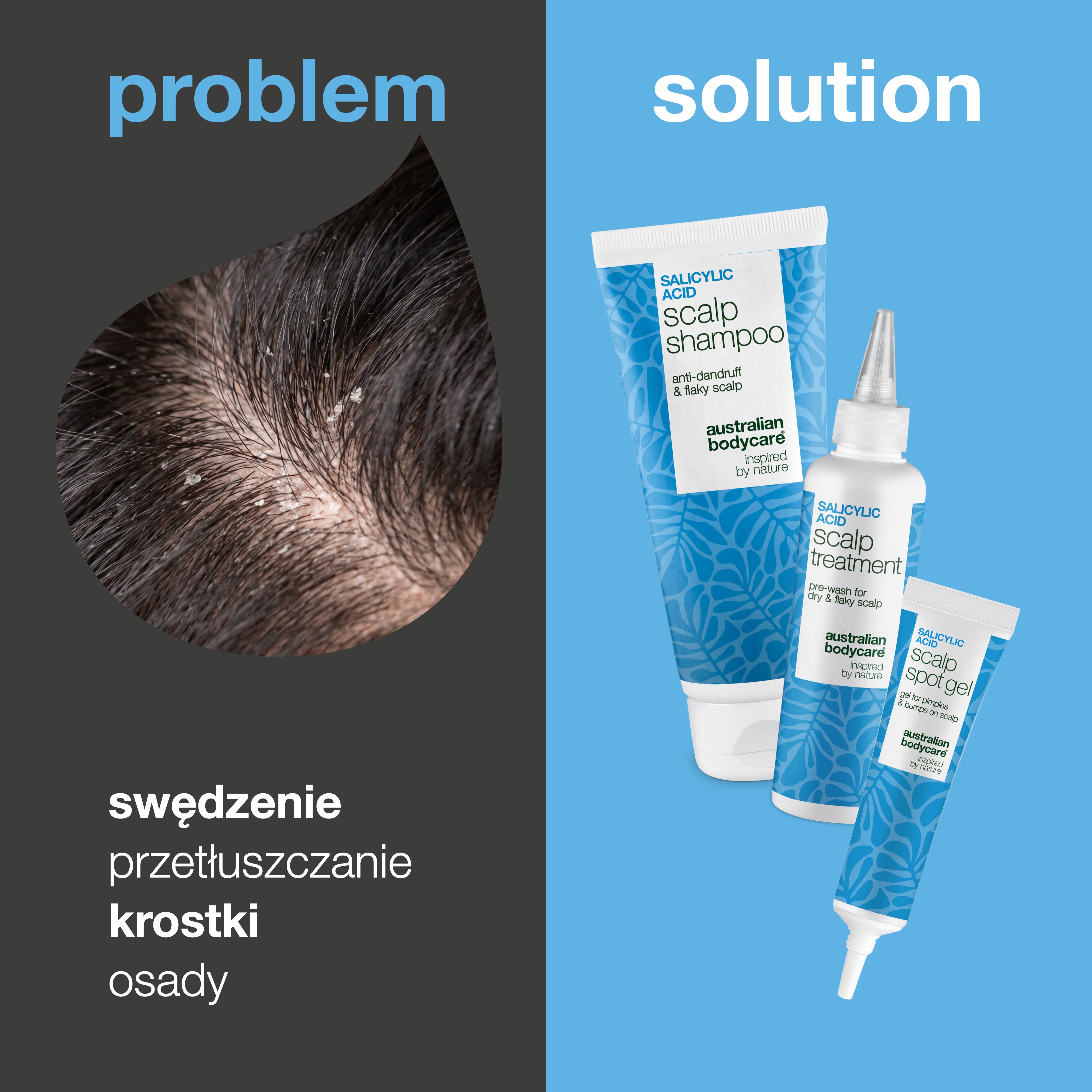 Problem i rozwiązanie: zbliżenie świądu, przetłuszczających się włosów i zanieczyszczeń obok trzech produktów z zestawu