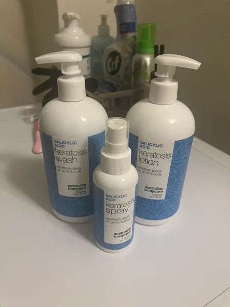 Efekt klienta keratosis pilaris – Isabell C.