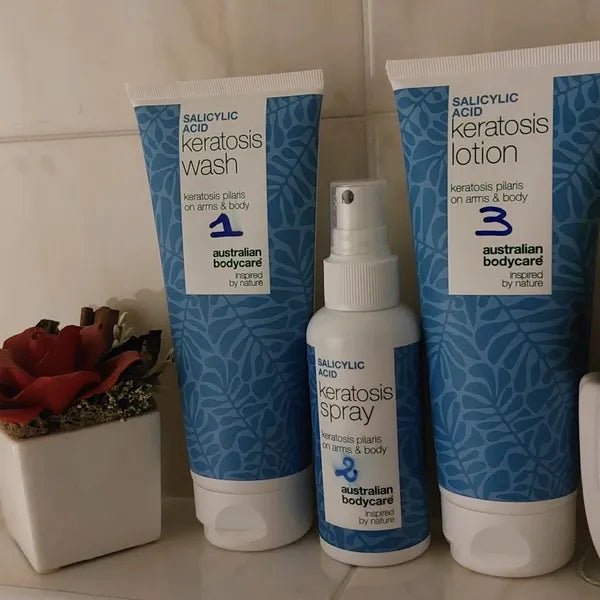 Efekt klienta keratosis pilaris – Michela C.