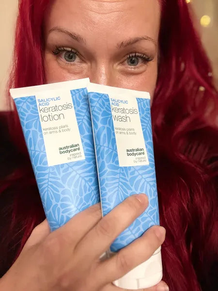 Efekt klienta keratosis pilaris – Viktorija K.