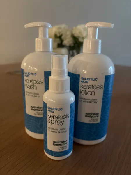 Efekt klienta keratosis pilaris – Walter P.
