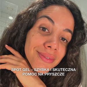 Żel Punktowy z Kwasem Salicylowym na pryszcze i zaskórniki — Żel Punktowy z Kwasem Salicylowym usuwa sebum i martwe komórki. Skuteczna pielęgnacja z kwasem salicylowym dla czystszej skóry.