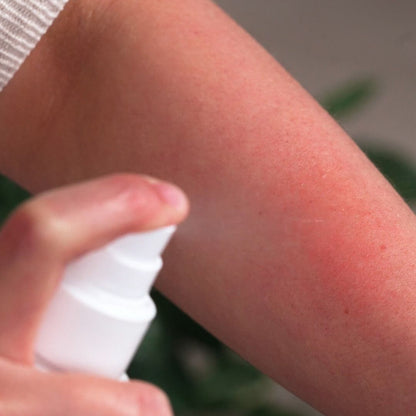 Spray przeciwświądowy - Spray łagodzący dla swędzącej i podrażnionej skóry